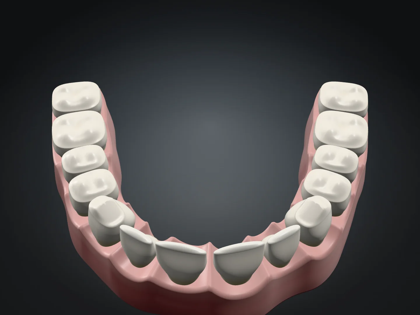 Allineamento illustrativo: lo stesso modello con i denti allineati lungo l’arcata
