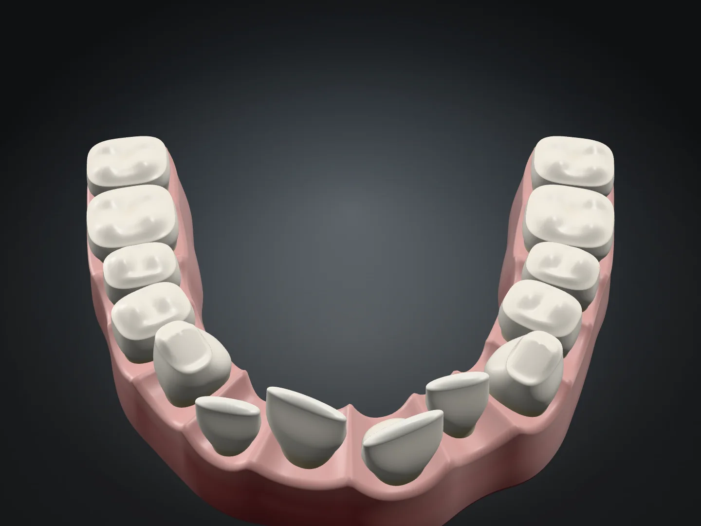 Posizione iniziale: modello illustrativo con alcuni denti anteriori ruotati e fuori arcata